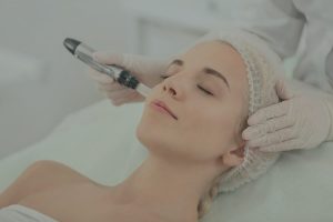 Microneedling with green